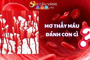 Mơ thấy máu là điềm báo gì? Gợi ý con số may mắn đánh lô đề 