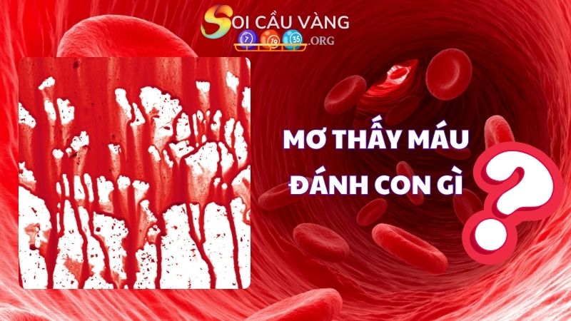 Mơ thấy máu đánh con gì dễ trúng lô đề?