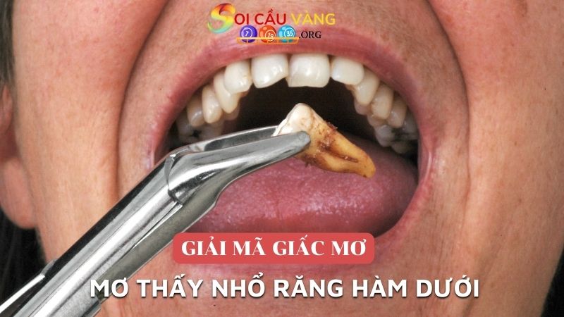 Mơ thấy nhổ răng hàm dưới